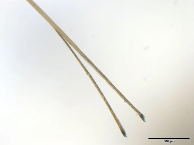 Magnified image of a hair with a split end